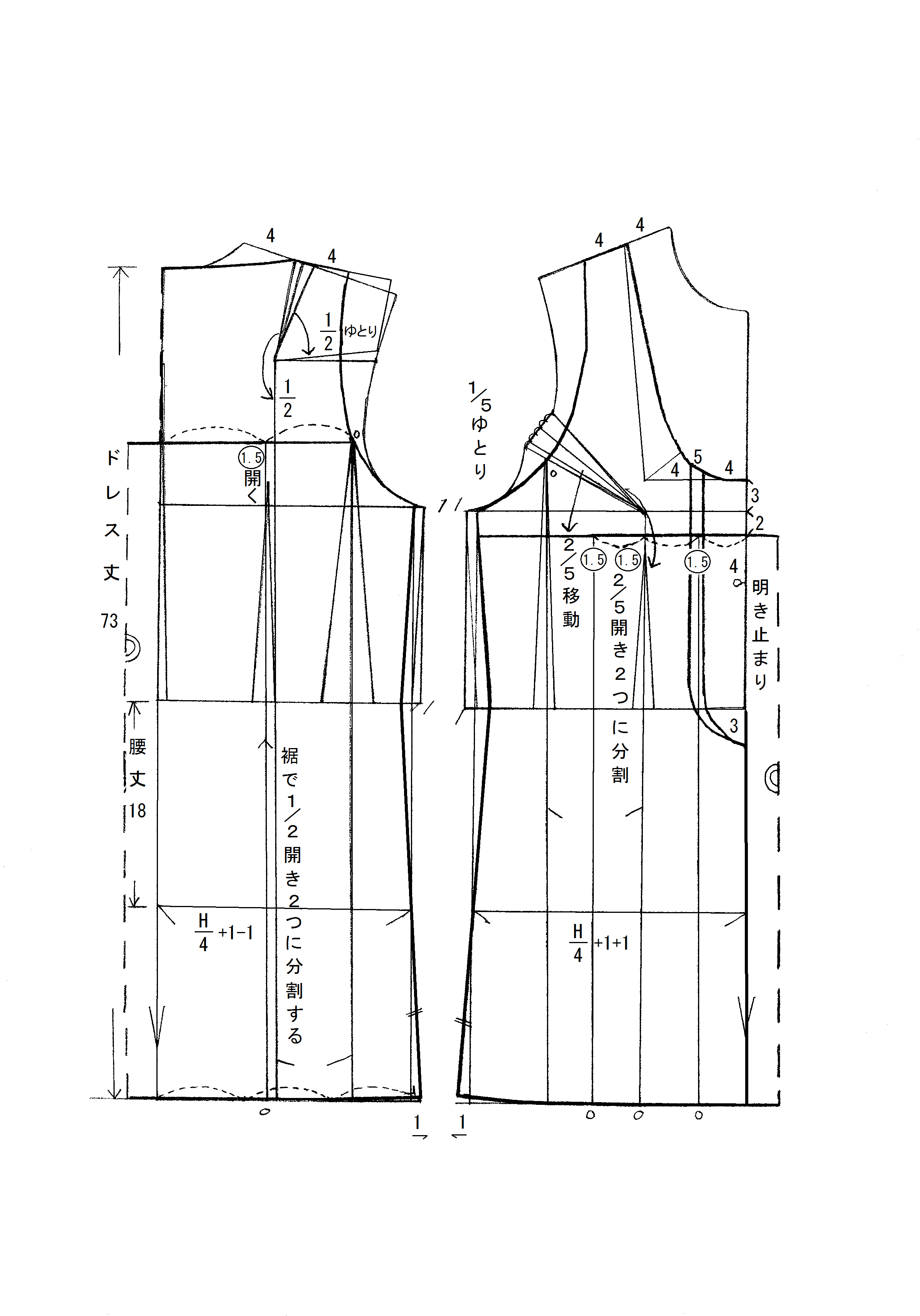 ニューガーリートップのパターン